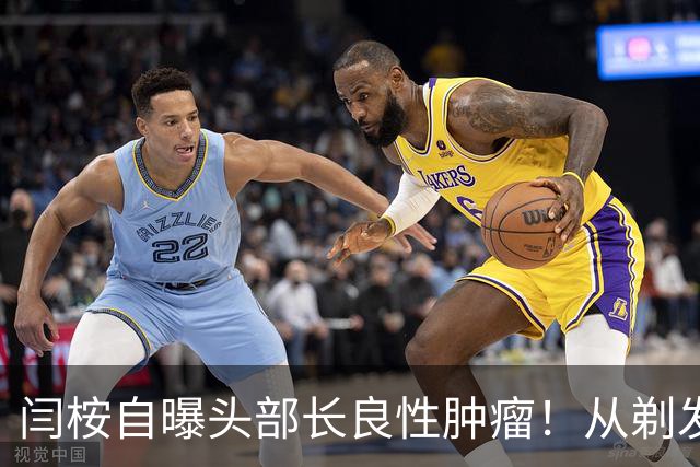 闫桉自曝头部长良性肿瘤！从剃发上手术台到《嫁金钗》播出